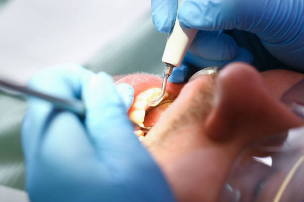 Best Walk-In Emergency Dental Services in Captains Cove, VA